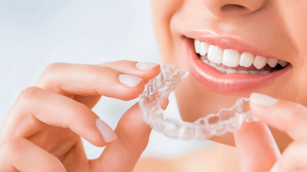 Invisalign em São Paulo Clinica WellClinic Odontologia
